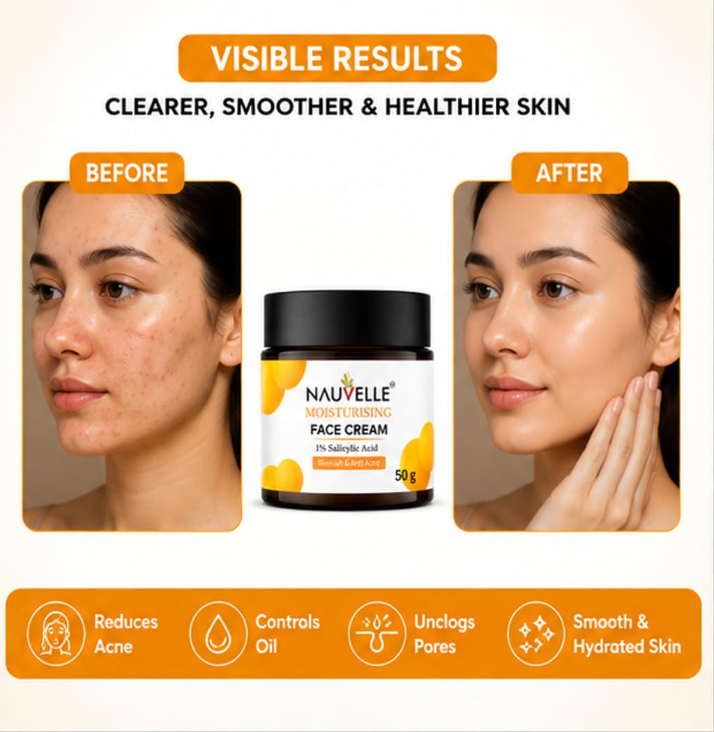 Nauvelle Moisturising Face Cream with 1% Salicylic Acid, Blemish & Anti Acne, 50 g