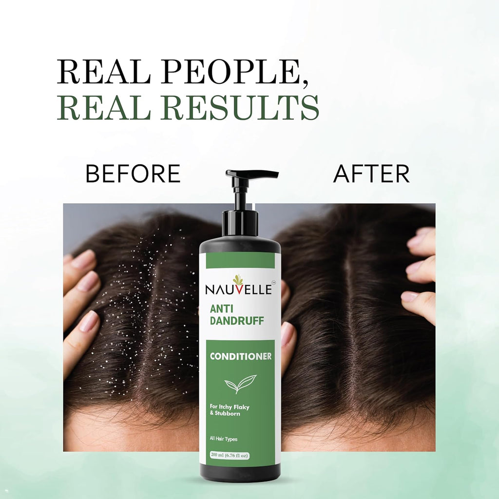 Nauvelle Anti Dandruff Conditioner with Rosemary Extract, for Itchy Flaky and Stubborn Dandruff, All Hair Types, 200 ml