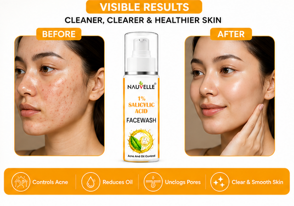 Nauvelle 1% Salicylic Acid Face Wash, Gel, Acne and Oil Control, Paraben Free, 100 ml