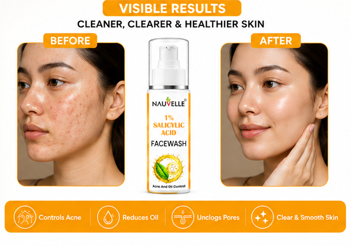 Nauvelle 1% Salicylic Acid Face Wash, Gel, Acne and Oil Control, Paraben Free, 100 ml