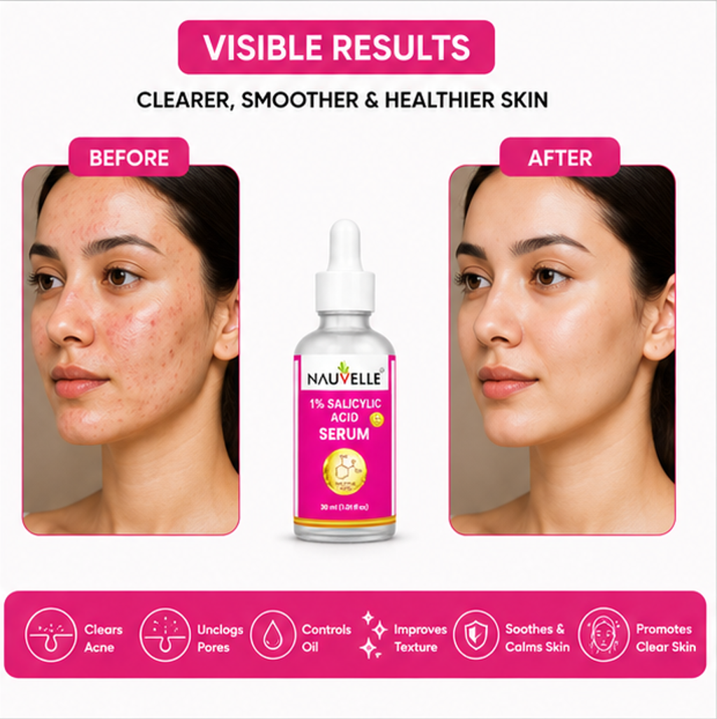 Nauvelle 1% Salicylic Acid Serum, 30 ml, Dropper Bottle, for Anti Hair Fall and Hair Regrowth