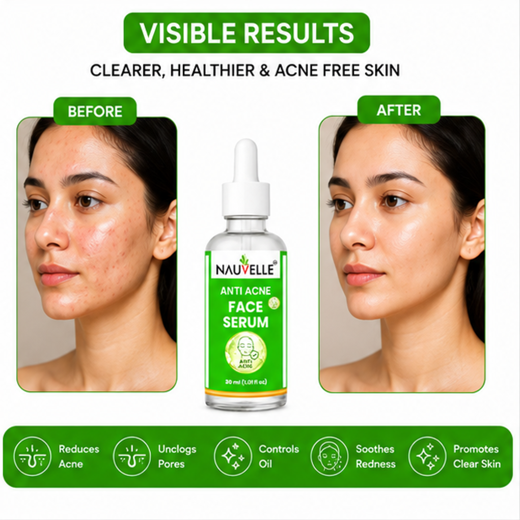 Nauvelle Anti Acne Face Serum for Clearer Skin, 30 ml, Adult