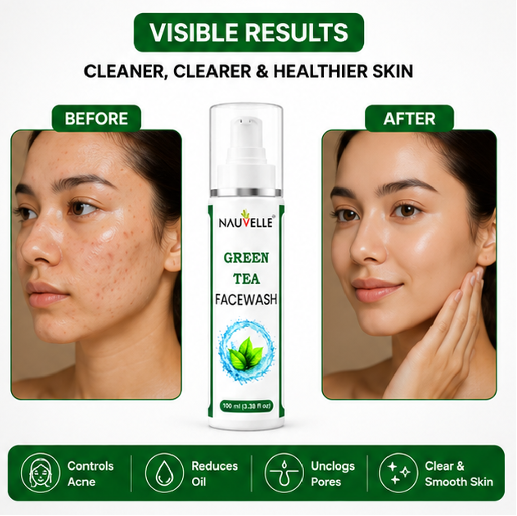 Nauvelle™ Green Tea Facewash, 100 ml
