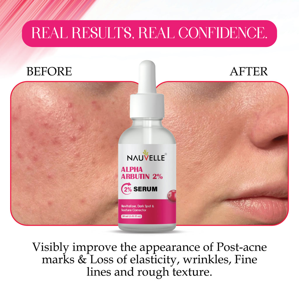 Nauvelle Alpha Arbutin 2% Serum, Revitalizer, Dark Spot & Texture Corrector, 30ml