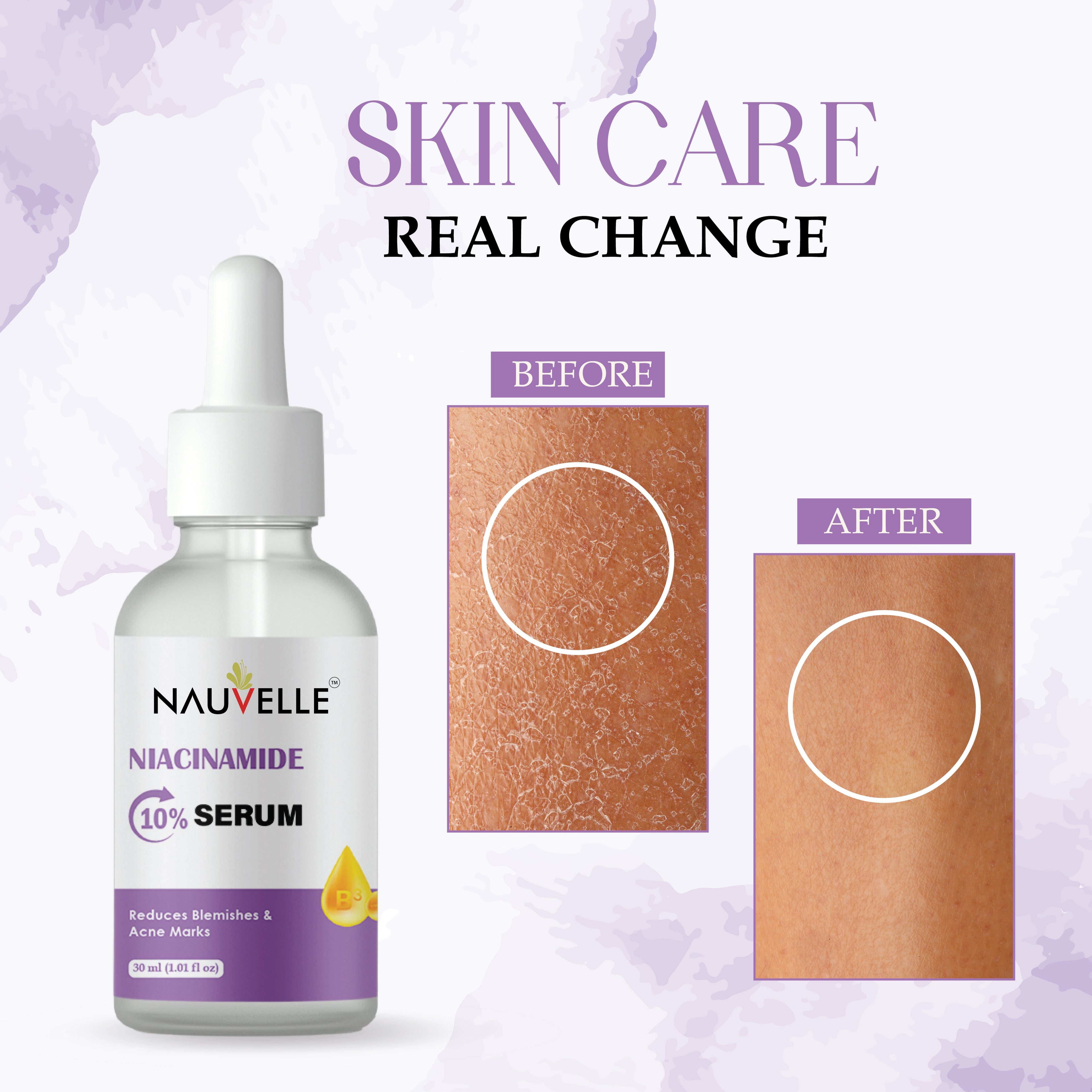 Nauvelle Niacinamide 10% Serum, Reduces Blemishes & Acne Marks, 30ml