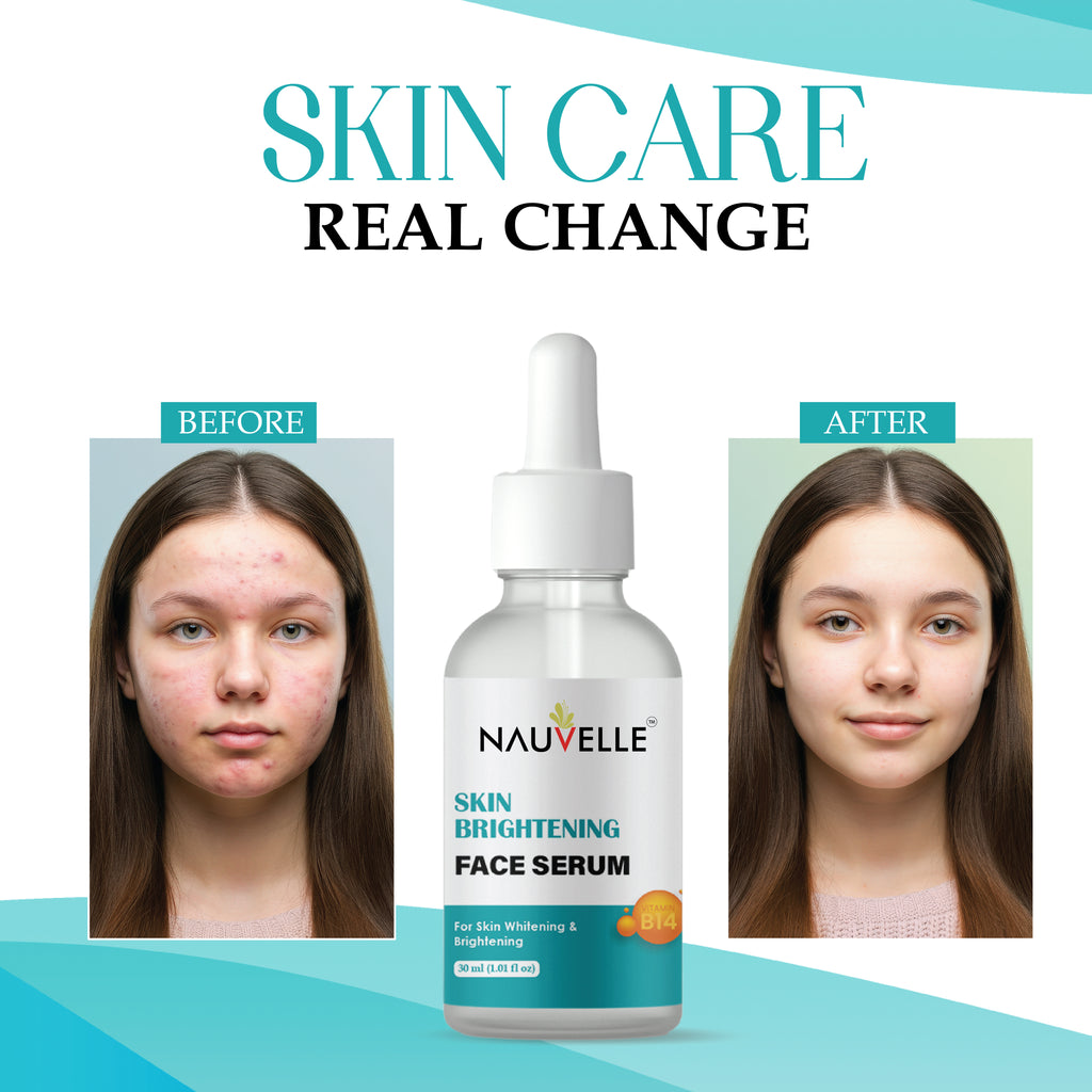 Nauvelle Skin Brightening Face Serum with Vitamin B14, for Whitening & Brightening, 30ml