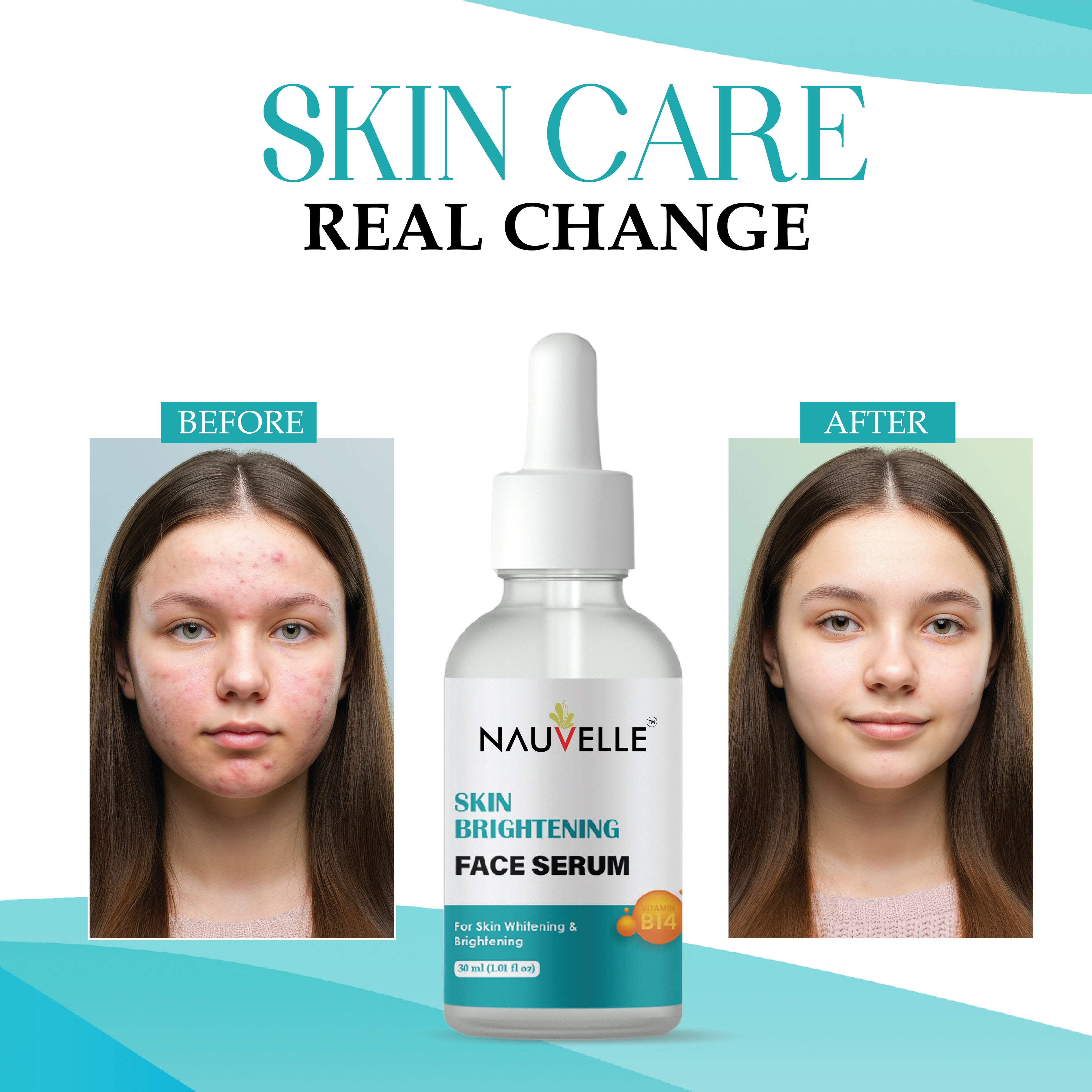 Nauvelle Skin Brightening Face Serum with Vitamin B14, for Whitening & Brightening, 30ml