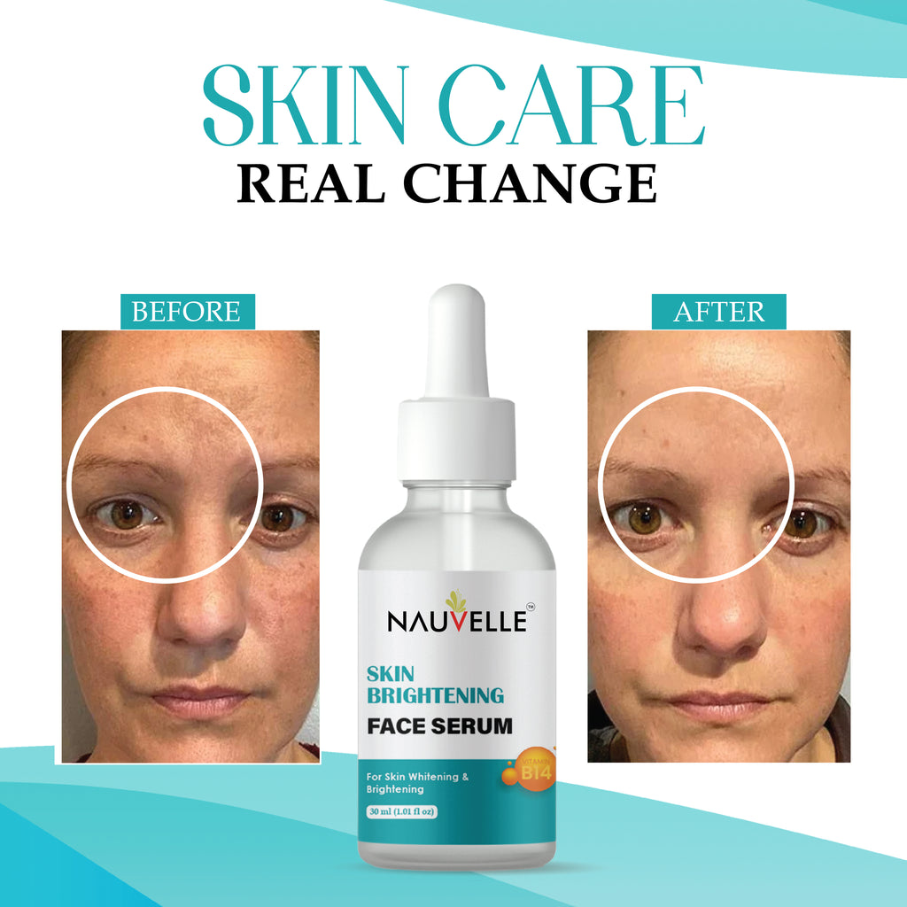 Nauvelle Skin Brightening Face Serum with Vitamin B14, for Whitening & Brightening, 30ml