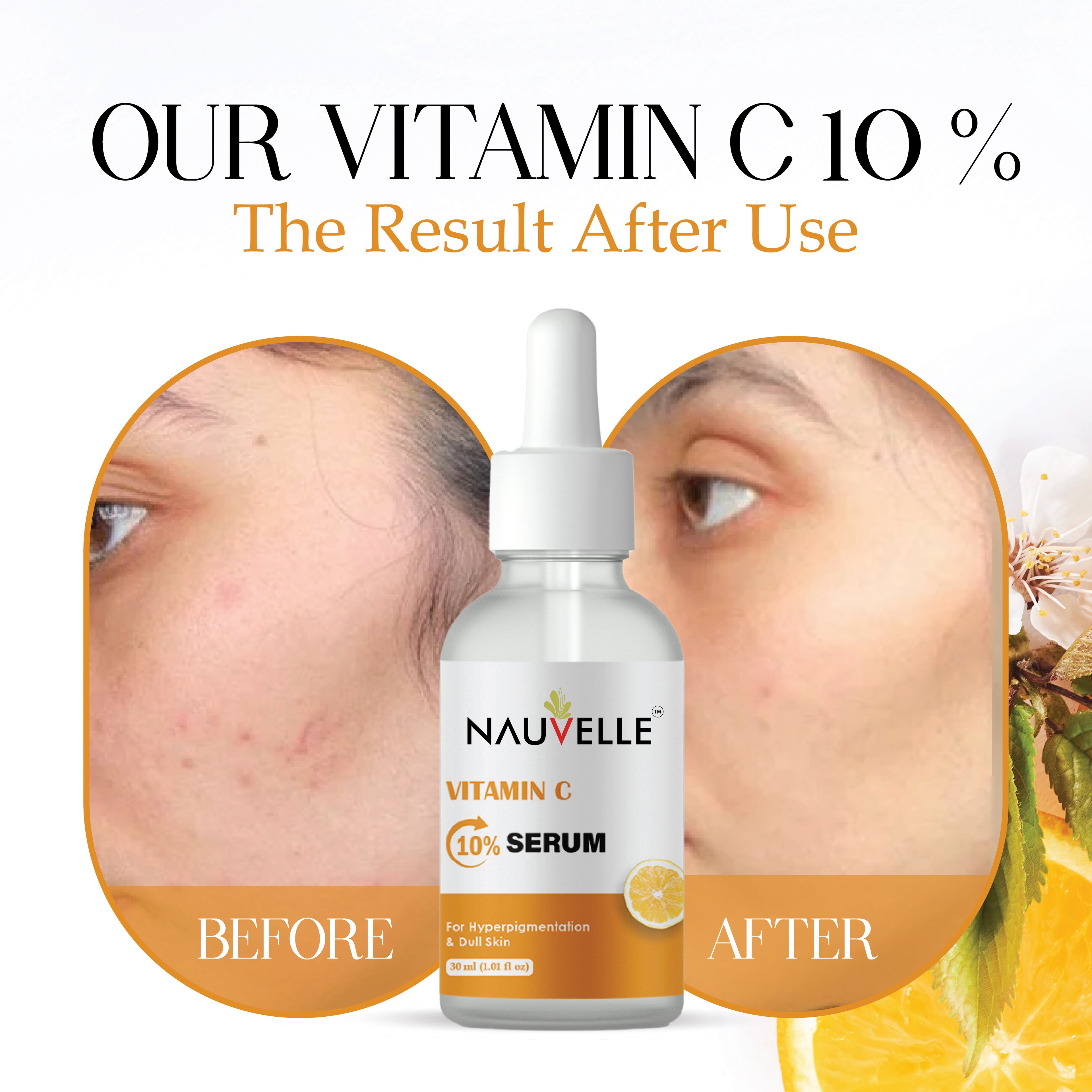 Nauvelle Vitamin C 10% Serum for Hyperpigmentation & Dull Skin_30ml